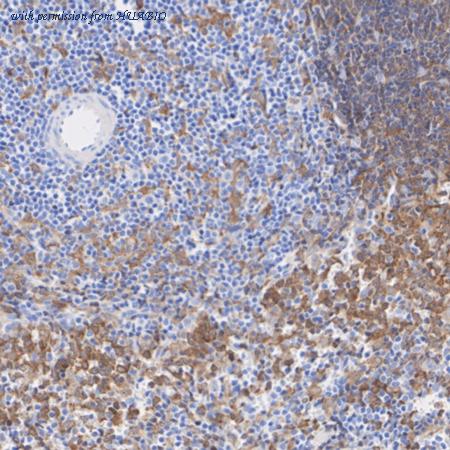 HUABIO ET1612-15 image 3