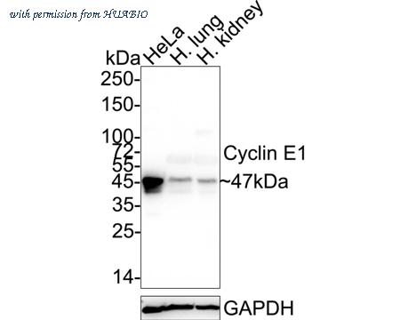 HUABIO ET1612-16 image 1