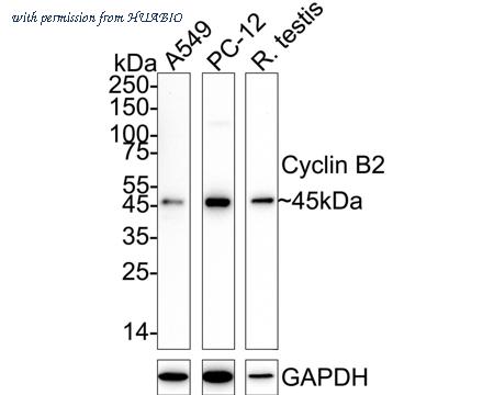 HUABIO ET1612-21 image 2
