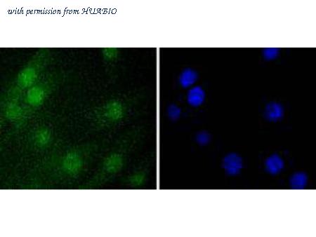 HUABIO ET1612-24 image 2