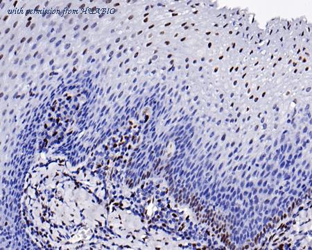 HUABIO ET1612-24 image 3