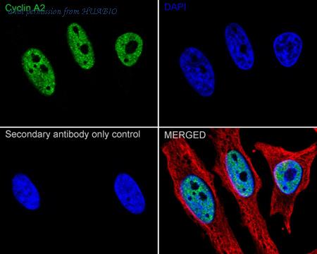 HUABIO ET1612-26 image 3
