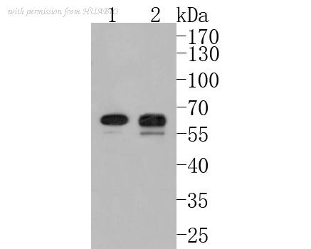 HUABIO ET1612-27 image 1