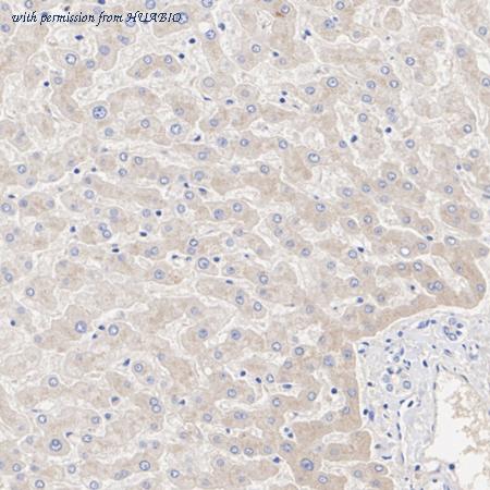 HUABIO ET1612-29 image 2