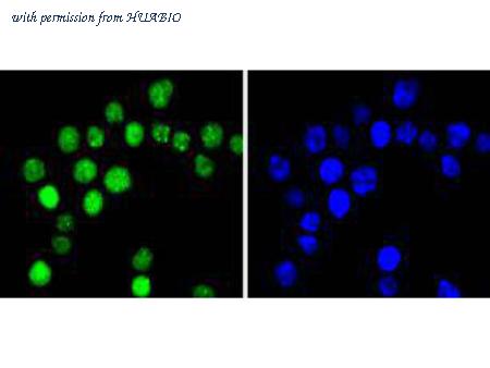 HUABIO ET1612-31 image 1