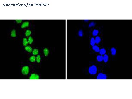 HUABIO ET1612-31 image 2