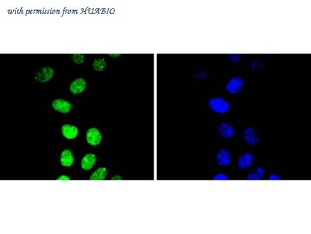 HUABIO ET1612-31 image 3