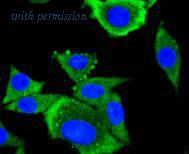 HUABIO ET1612-33 image 3