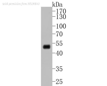 HUABIO ET1612-34 image 1
