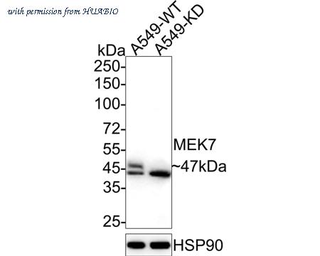 HUABIO ET1612-35 image 1