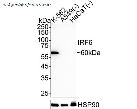 HUABIO ET1612-36 image 1
