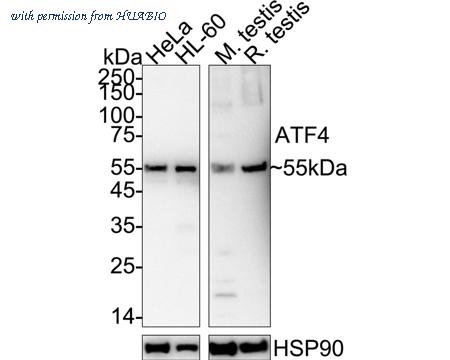 HUABIO ET1612-37-50UL image 1