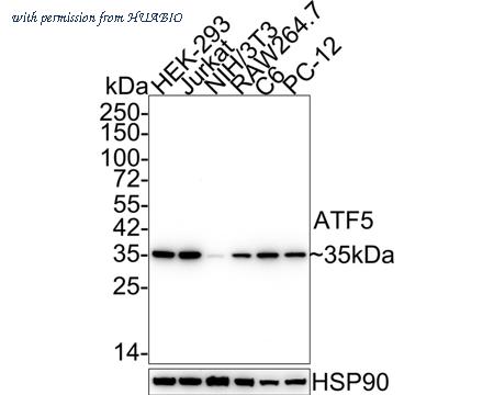 HUABIO ET1612-38-50UL image 1