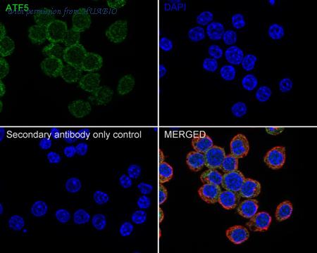 HUABIO ET1612-38-50UL image 3