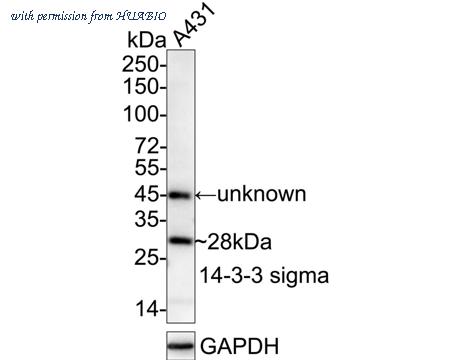 HUABIO ET1612-41 image 1