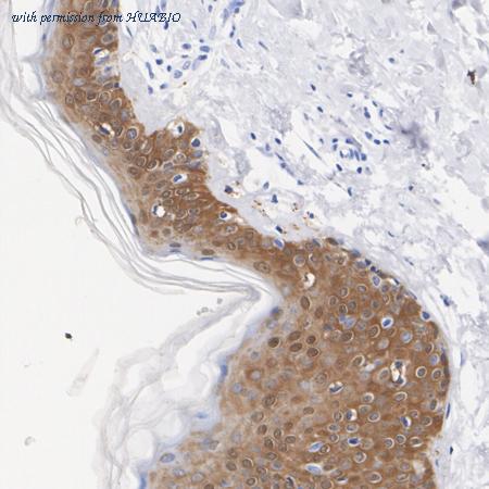 HUABIO ET1612-41 image 2