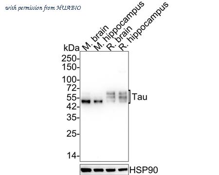 HUABIO ET1612-44 image 1