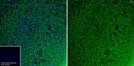 HUABIO ET1612-44 image 2