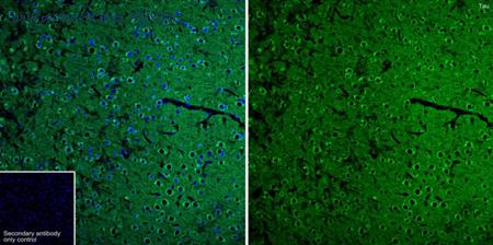 HUABIO ET1612-44 image 3