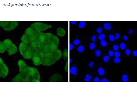 HUABIO ET1612-45 image 1