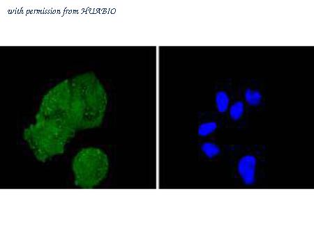 HUABIO ET1612-45 image 2