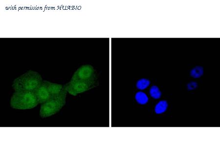 HUABIO ET1612-45 image 3