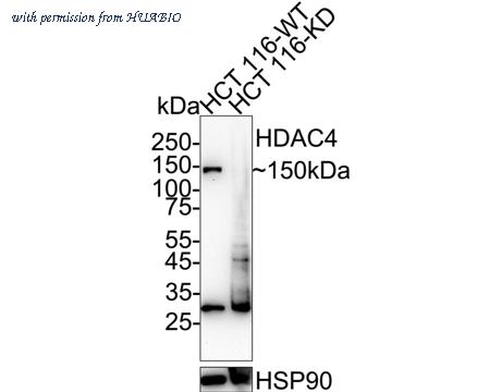 HUABIO ET1612-51 image 1