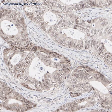 HUABIO ET1612-51 image 2