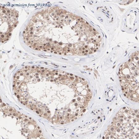 HUABIO ET1612-51 image 3