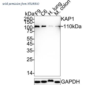 HUABIO ET1612-55 image 1