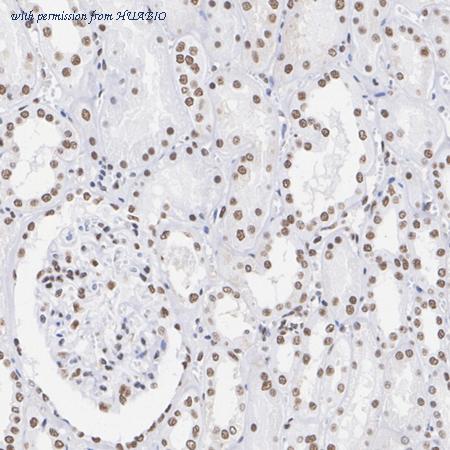 HUABIO ET1612-55 image 2