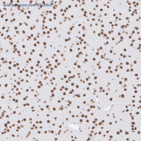 HUABIO ET1612-55 image 3