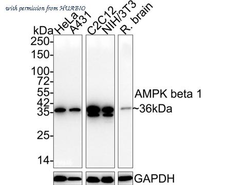 HUABIO ET1612-56 image 1