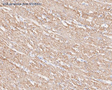 HUABIO ET1612-56 image 2