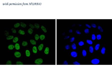 HUABIO ET1612-57 image 3