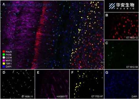 HUABIO ET1612-58 image 2
