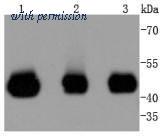 HUABIO ET1612-6 image 1