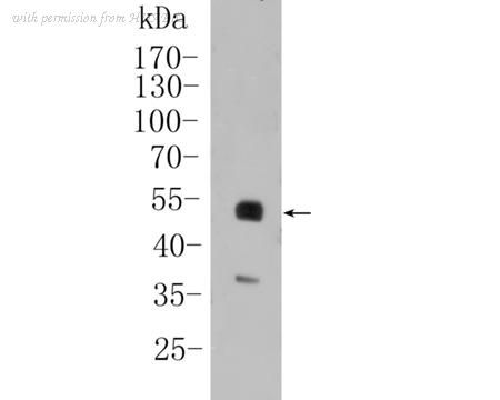 HUABIO ET1612-61 image 1