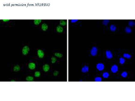 HUABIO ET1612-61 image 2