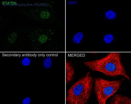 HUABIO ET1612-63 image 3