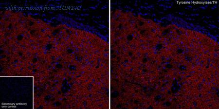 HUABIO ET1612-65 image 1