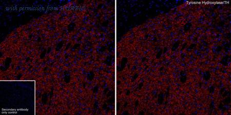 HUABIO ET1612-65 image 2