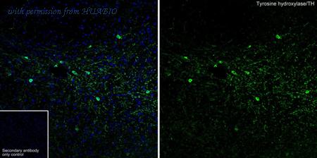 HUABIO ET1612-65 image 3