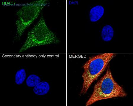 HUABIO ET1612-67 image 2