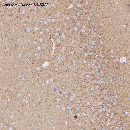 HUABIO ET1612-68 image 3