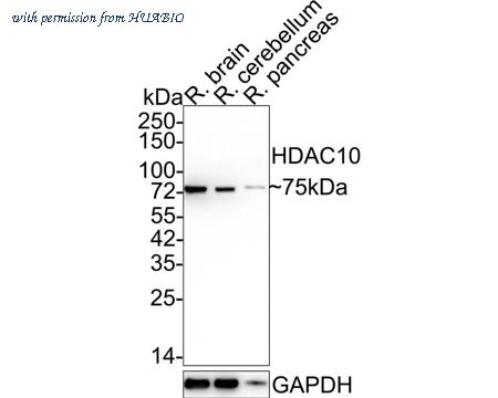 HUABIO ET1612-69 image 1