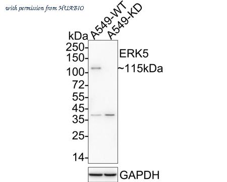 HUABIO ET1612-7 image 2