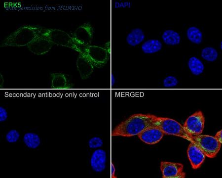 HUABIO ET1612-7 image 3
