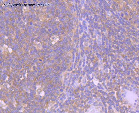 HUABIO ET1612-70 image 3