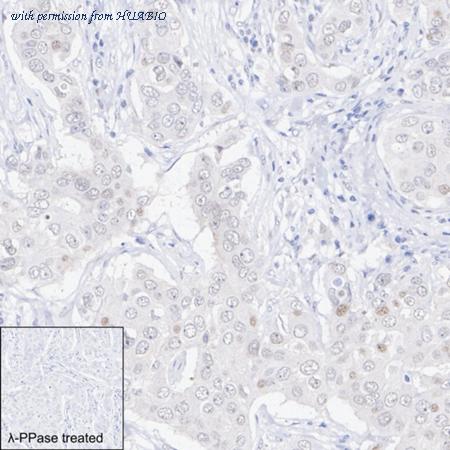 HUABIO ET1612-73 image 2